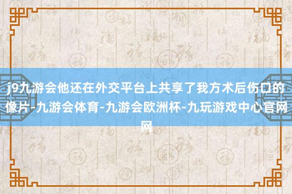 j9九游会他还在外交平台上共享了我方术后伤口的像片-九游会体育-九游会欧洲杯-九玩游戏中心官网